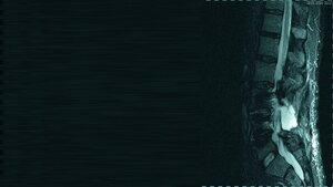 Schnittbildverfahren