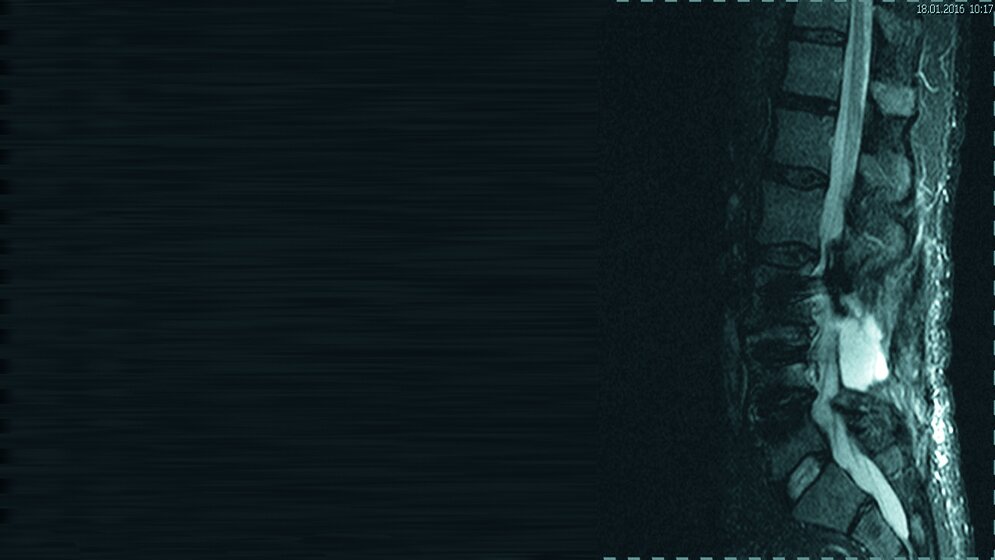 Schnittbildverfahren