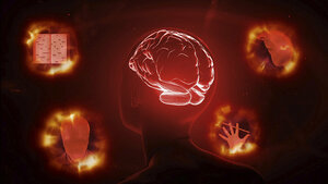 Alzheimer’s Disease