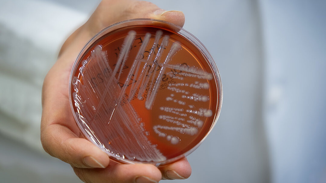 Hand hält eine Petrischale mit aufgestrichenen Bakterienkulturen fest, weißer unscharfer Hintergrund