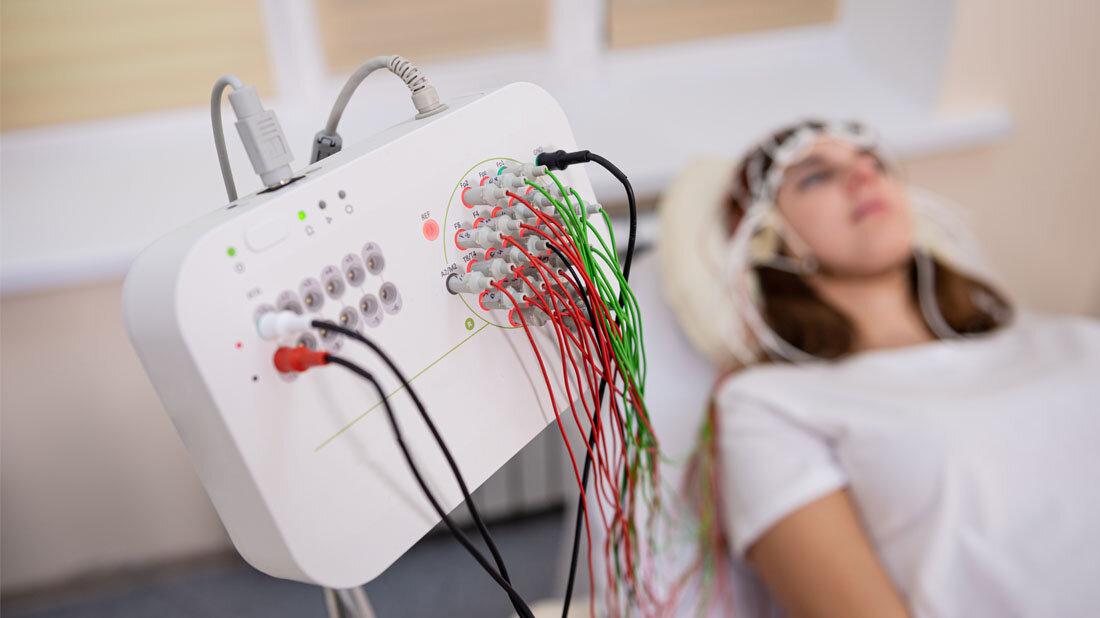 Wie kann Datenschutz für EEG-Daten aussehen?