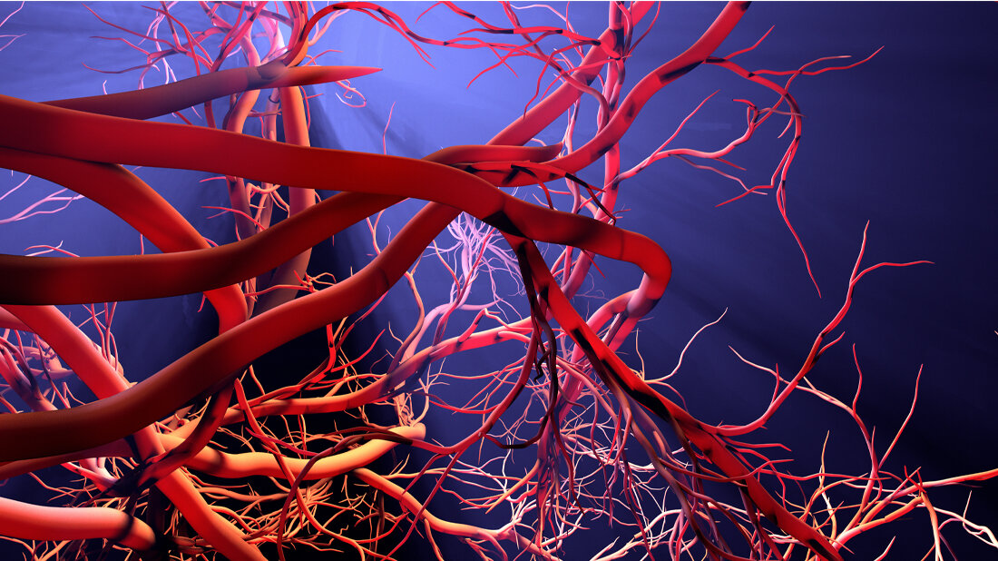Optimierung des Gefäßsystems