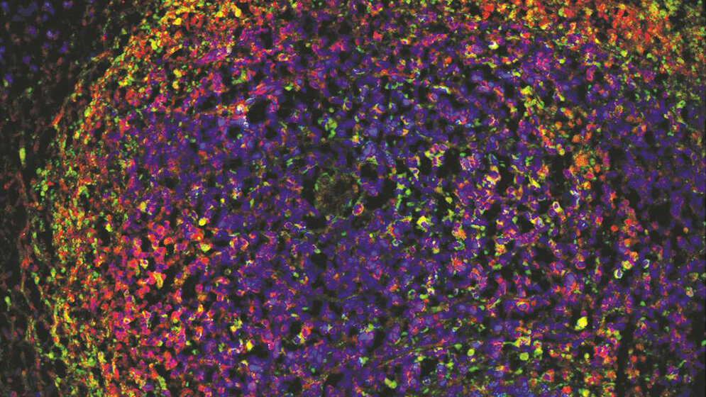 Immunfluoreszenzfärbung