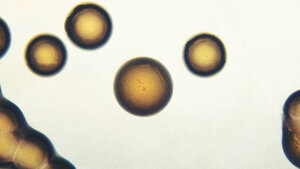 Neisseria gonorrhoeae