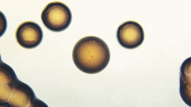 Mikrobiologie Neisseria gonorrhoeae