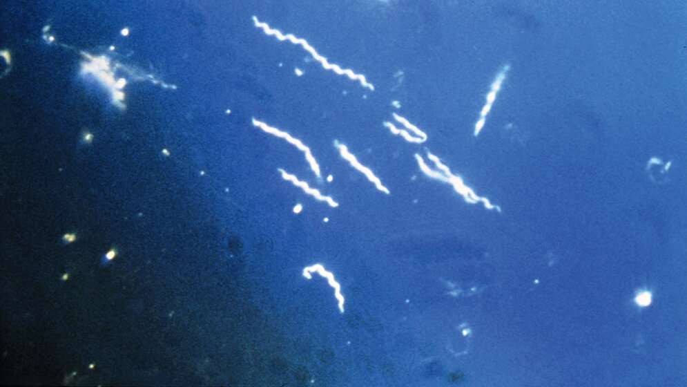 Mikrobiologie Lyme-Borreliose