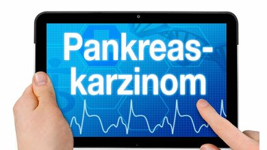 pankreas_onlinejpg.jpg Neue Therapieoptionen gegen Bauchspeicheldrüsenkrebs