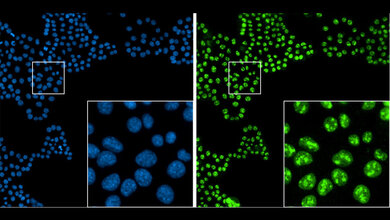 Immunfluoreszenzaufnahme_Bauchspeicheltumordruesenzellen.jpg Immunfluoreszenzaufnahme von Bauchspeicheldrüsentumorzellen in Zellkultur.