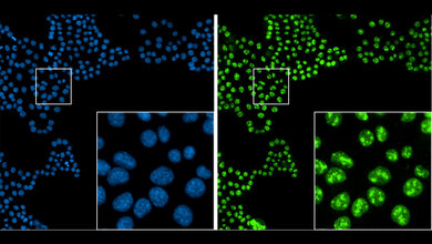 Immunfluoreszenzaufnahme von Bauchspeicheldrüsentumorzellen in Zellkultur. 