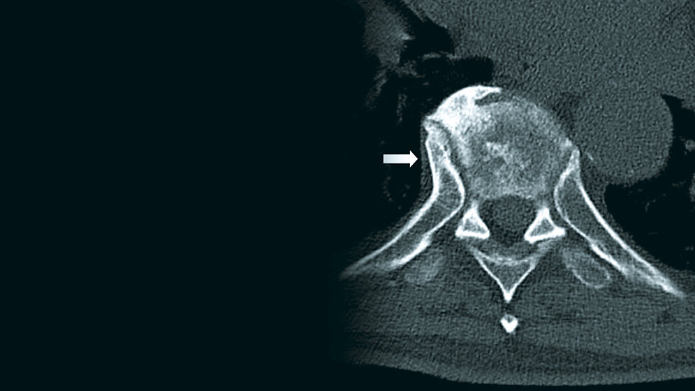 Bildgebende Verfahren