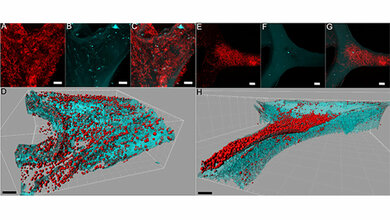 Bakterien in Küchenschwämmen