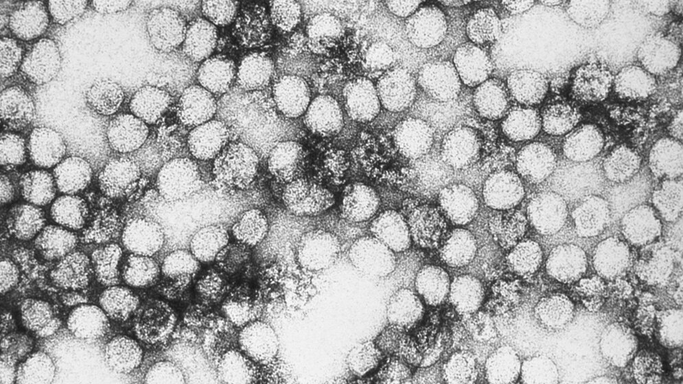 57 epidemische Ausbrüche von Gelbfieber