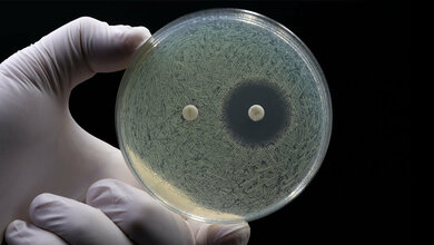 Test auf Antibiotikaresistenz