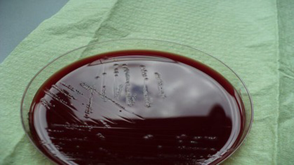 Aktuelles zu Clostridium difficile Labordiagnostik