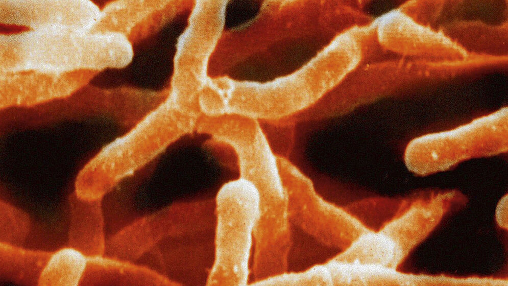 Schnittbilddiagnostik der Wirbelsäule