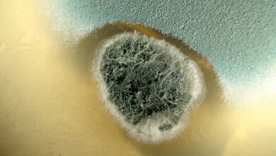 Foto von Stachybotris und Aspergillus fumigatus