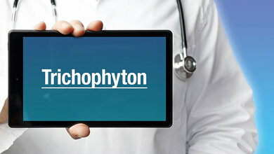 Titelbild des Fachbeitrags zur globalen Ausbreitung des multiresistenten Hautpilzes Trichophyton indotineae