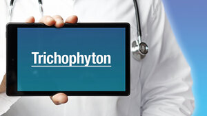 Titelbild des Fachbeitrags zur globalen Ausbreitung des multiresistenten Hautpilzes Trichophyton indotineae