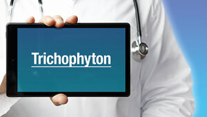 Titelbild des Fachbeitrags zur globalen Ausbreitung des multiresistenten Hautpilzes Trichophyton indotineae