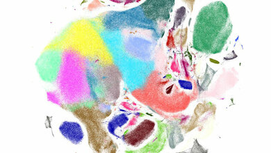 Visualisierung_Genexpressionsmuster_muriner_Gehirnzellen_Quelle_Helmholtz_Zentrum_Muenchen.jpg Visualisierung von Genexpressionsmustern