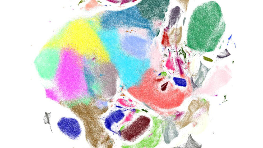 Visualisierung_Genexpressionsmuster_muriner_Gehirnzellen_Quelle_Helmholtz_Zentrum_Muenchen.jpg Visualisierung von Genexpressionsmustern