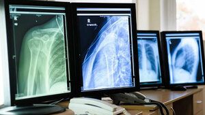 Das Belichtungspunktesystem und seine Bedeutung in der digitalen Radiographie (Teil 2)