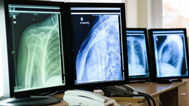 Bildgebende Verfahren Das Belichtungspunktesystem und seine Bedeutung in der digitalen Radiographie (Teil 2)