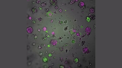 Brustkrebs-Organoide