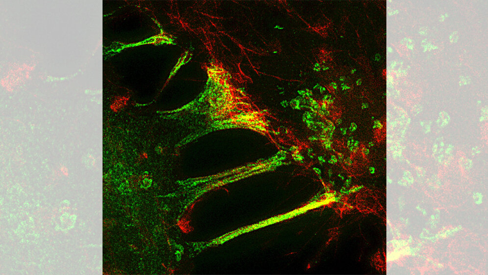 Wenn Zellen zu „Kannibalen“ werden