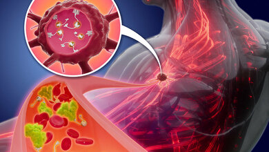 Alphastrahler als Hoffnungsträger für krebstherapie