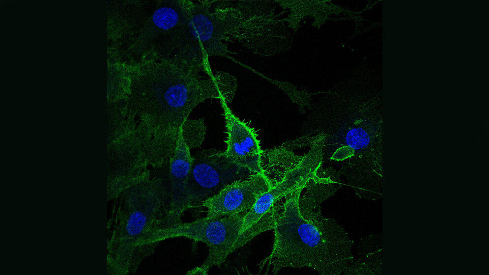 Lavins_Muskelzellpopulation_zeigt_starke_Expression_des_Oberflaechenproteins_CLEC14A_Spuler_Lab_MDC.jpg Lavins Muskelzellpopulation