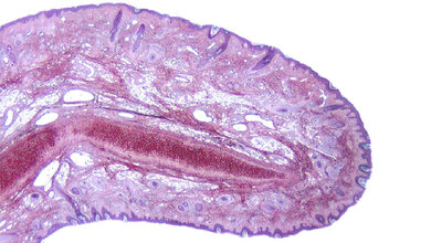 Histologische Darstellung von Nervenfasern.