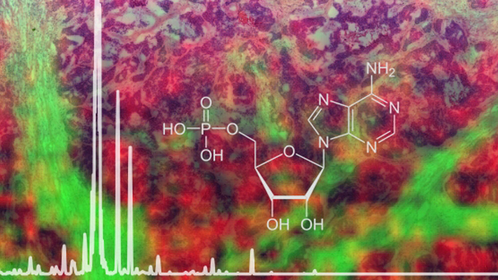 neues Protokoll für die bildgebende Massenspektrometrie