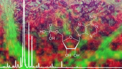 neues Protokoll für die bildgebende Massenspektrometrie