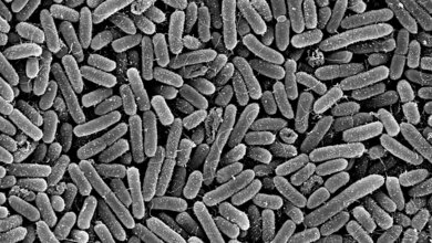 Pseudomonas aeruginosa mit dem Elektronenmikroskop aufgenommen.