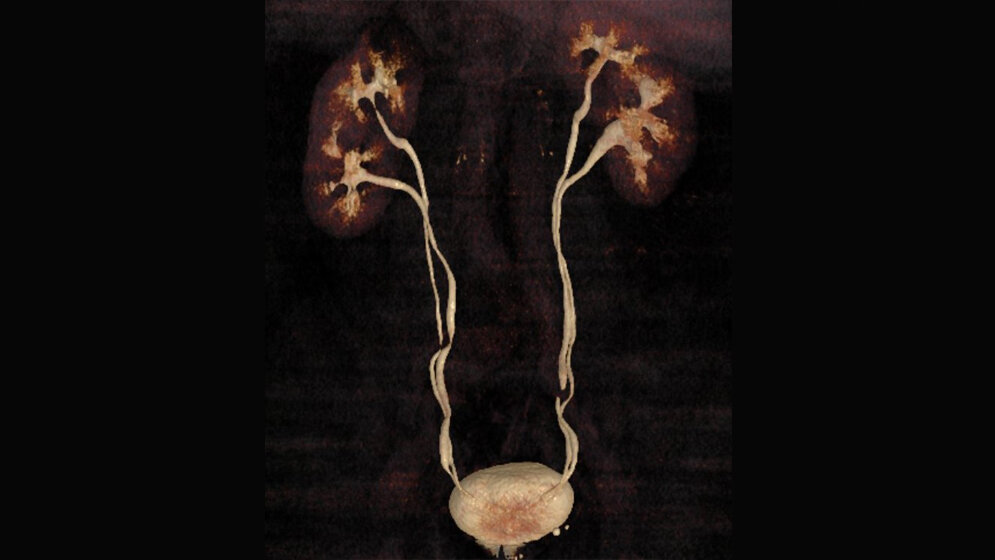 Anomalien und Normvarianten – Interne Veränderungen 2.13