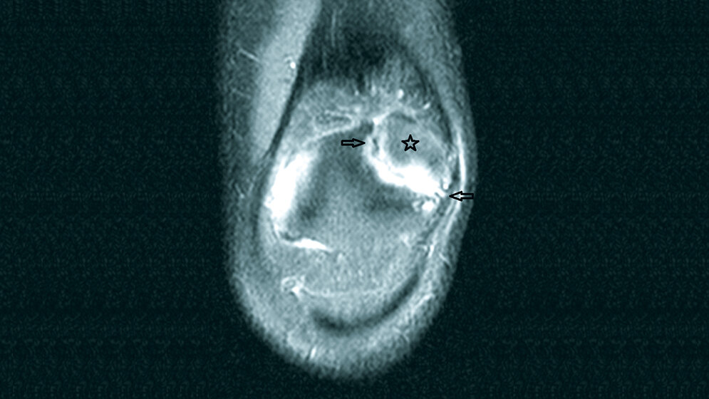 Anomalien und Normvarianten
