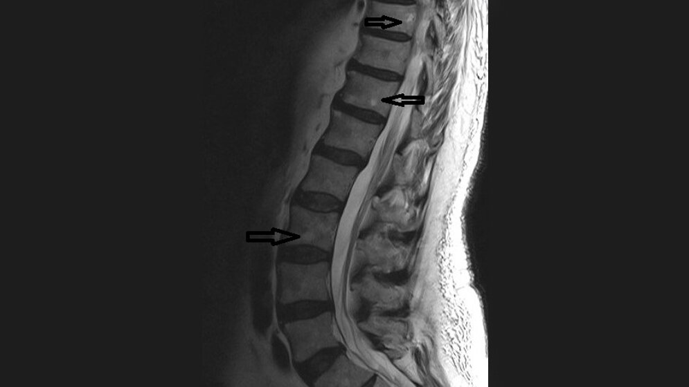 Anomalien und Normvarianten: Vaskuläre Malformationen 1.5