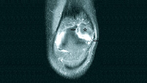 Anomalien und Normvarianten
