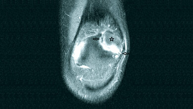Anomalien und Normvarianten