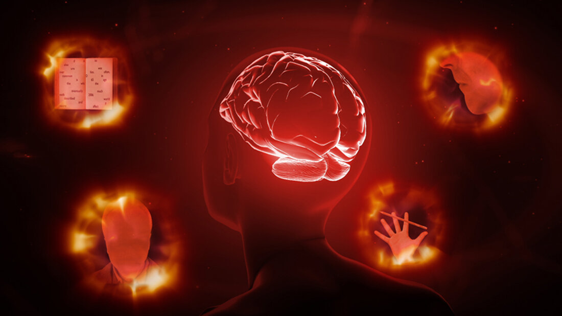 Alzheimer.jpg Morbus Alzheimer