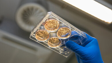 Hand mit blauem Handschuh hält eine Petrischale mit mehreren Proben unter einer Laborlampe.