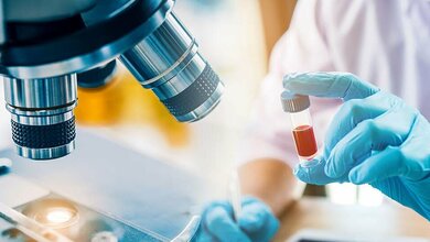 Bluttest_241382660_Preview.jpg Deutlich einfachere Diagnose