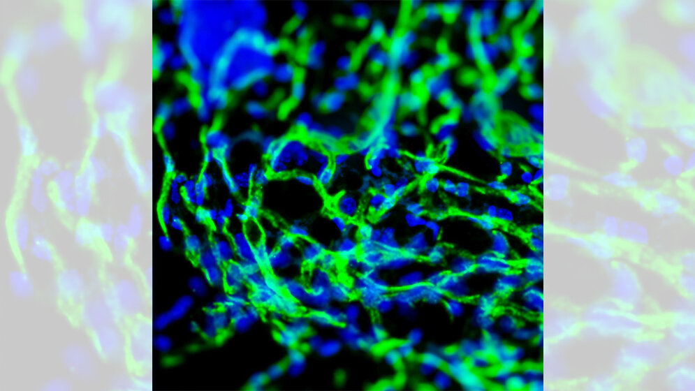 Die_Injektion_eines_Hydrogels_beeinflusst_das_Wachstum_neuer_Blutgefaesse_Foto_AG_Shastri.jpg Wachstum neuer Blutgefäße
