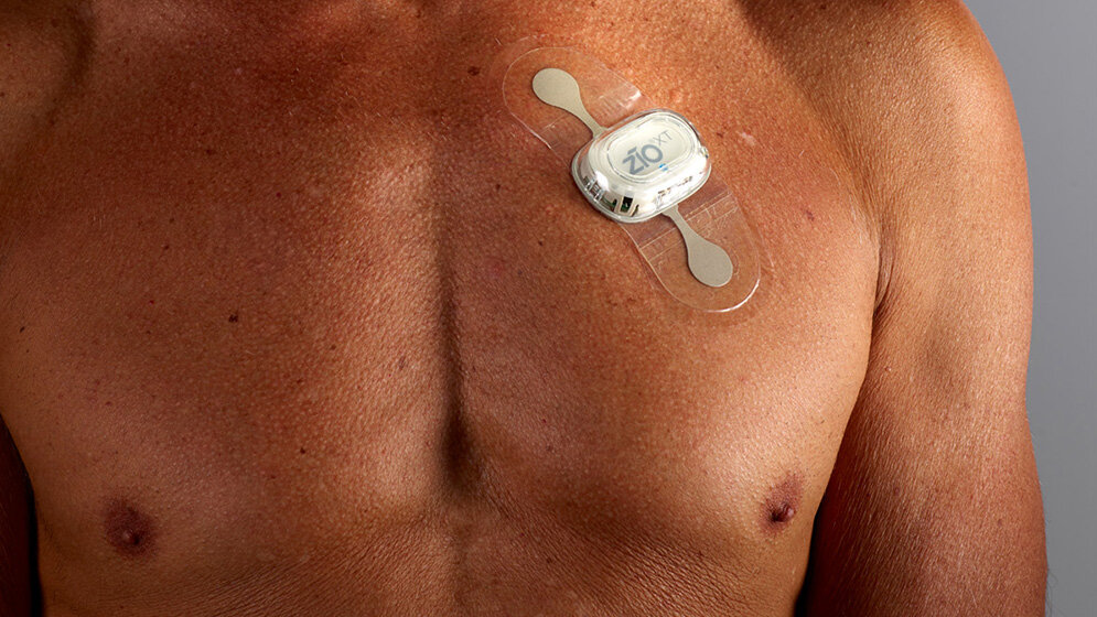 EKG_iRhythm_Technologies.jpg EKG-Aufzeichnung