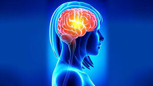 Medulla oblongata Infarkt