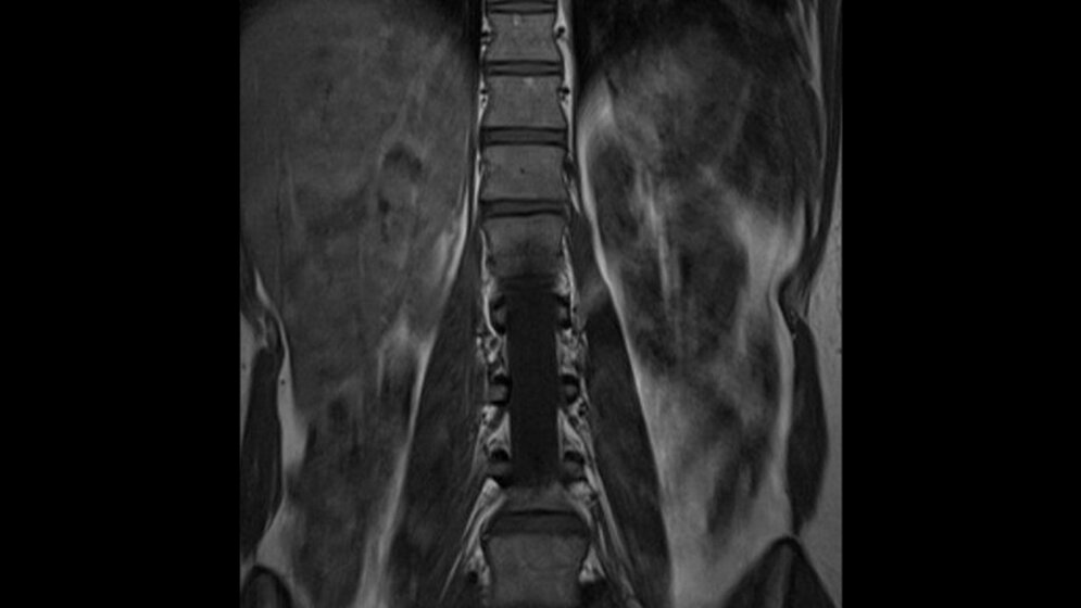 Schnittbilddiagnostik der Wirbelsäule