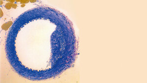 Risikofaktor Homocystein