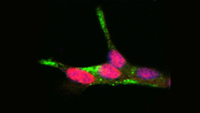Validierung von PDX1