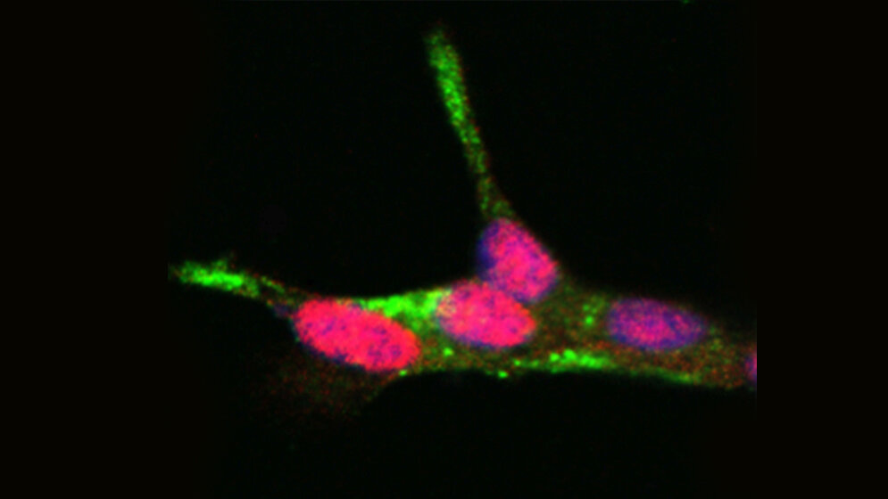 Validierung von PDX1